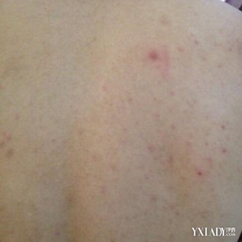 渭南皮肤病医院:寻找皮肤健康的守护者